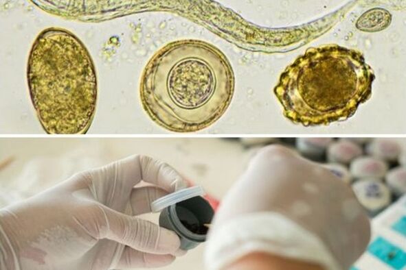 diagnose the presence of parasites in the body