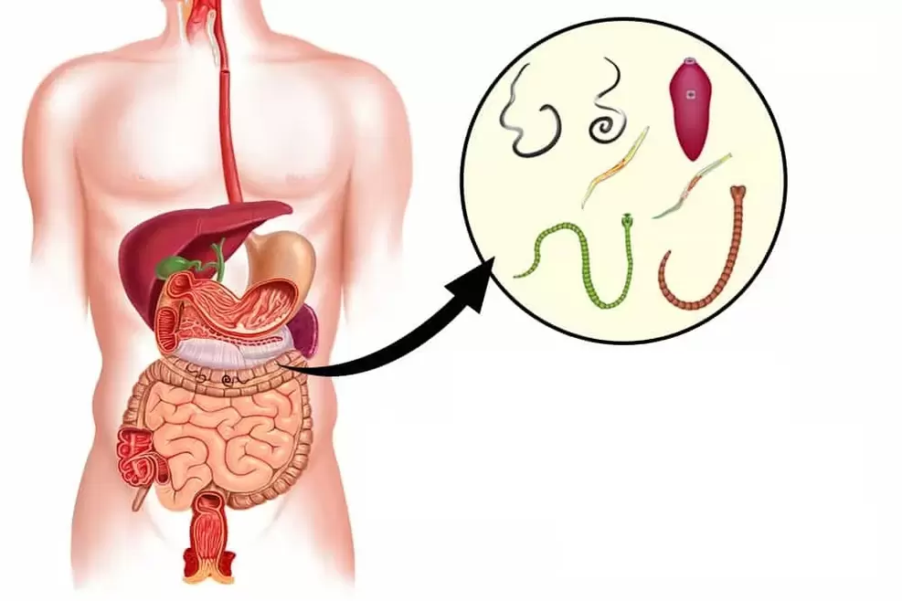 Worms are parasites in the intestines of humans
