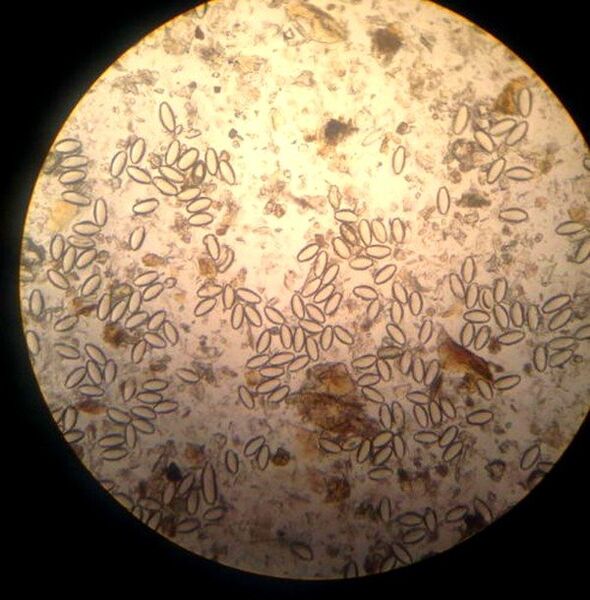 Pinworms are free-living, parasitic roundworms. 