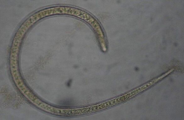 Trichinella is a protozoan parasitic roundworm