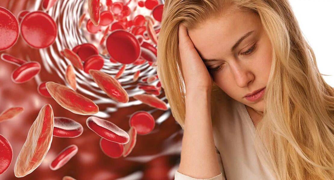 Anemia due to parasites