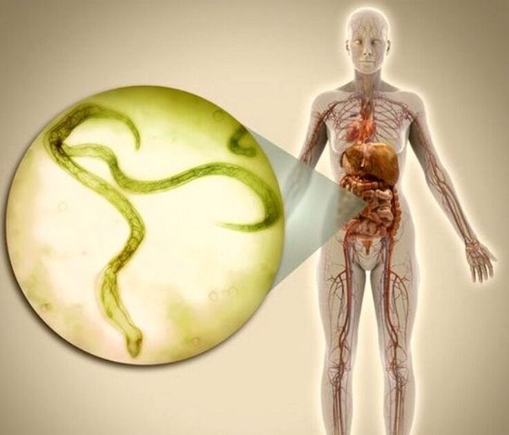 Parasites in the body