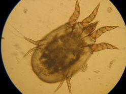 Marked under a microscope